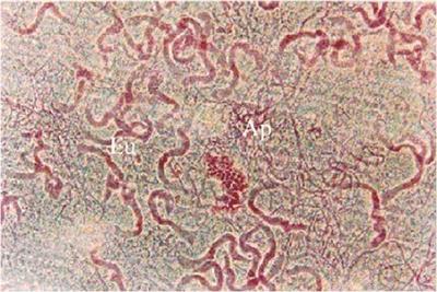 Dichotomous sperm in Lepidopteran insects: a biorational target for pest management